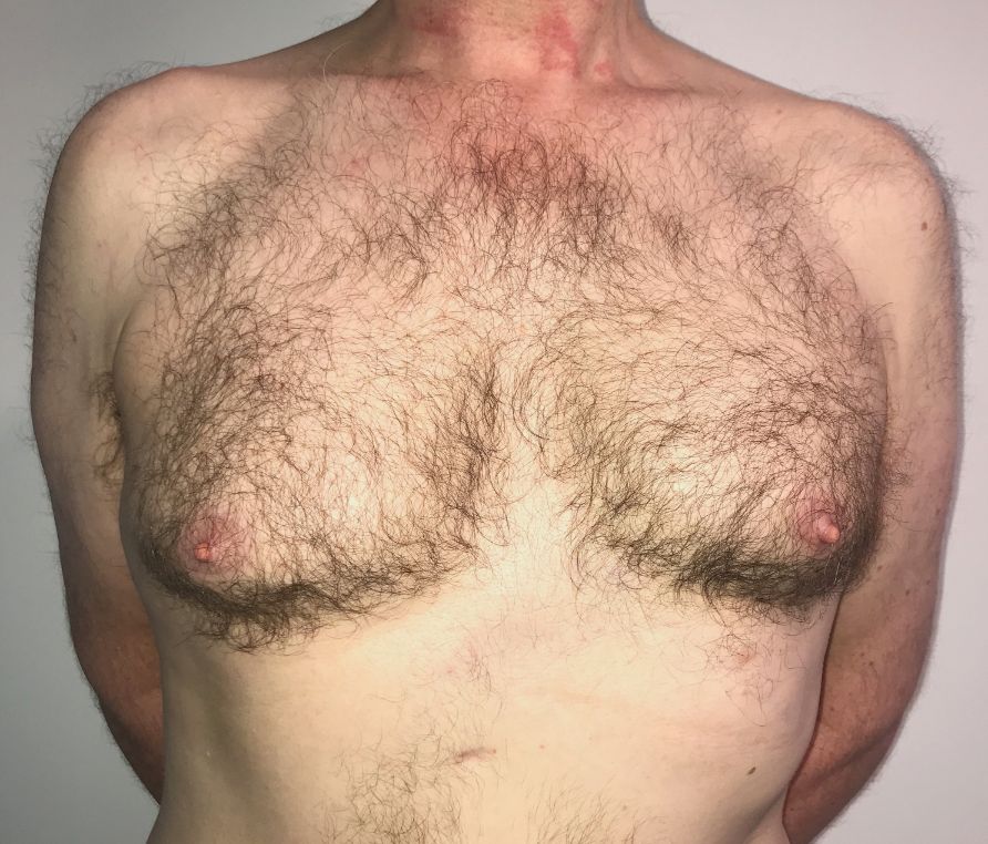 AP view gynae PR