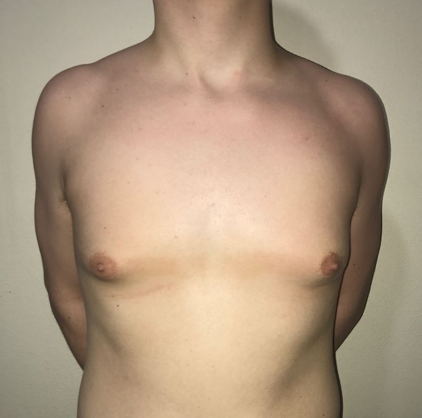 CB gynae pre-op AP