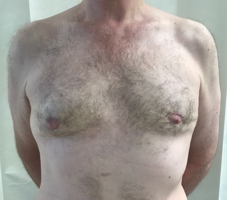 Post-op gynae AP PR