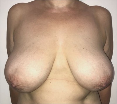 b1