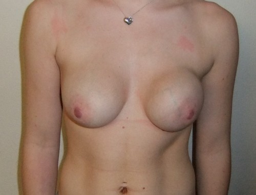 Before surgery 1